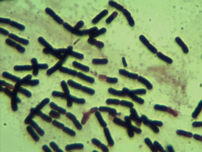 Vi Sinh Clostridium butyricum 