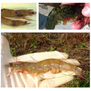 Hoại tử gan tụy cấp tính